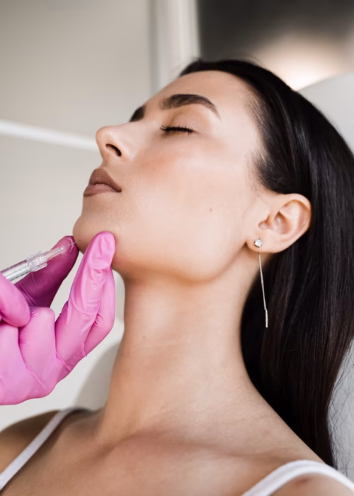 Relleno de mentón sevilla - Nurson