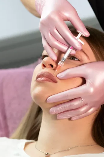 Relleno de labios clínica Madrid - Nurson